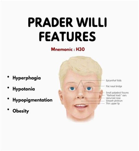 prader willi syndrome physical features.